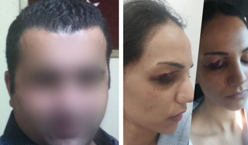 Emniyet müdürü  kadına dehşeti yaşattı:  ‘Kadına önce çıplak arama sonra işkence’ iddiası